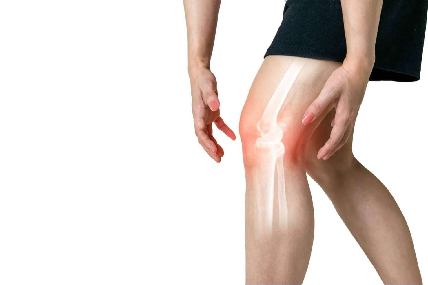 La asociación de pacientes de artrosis y osteoporosis OAFI colabora con iXalud