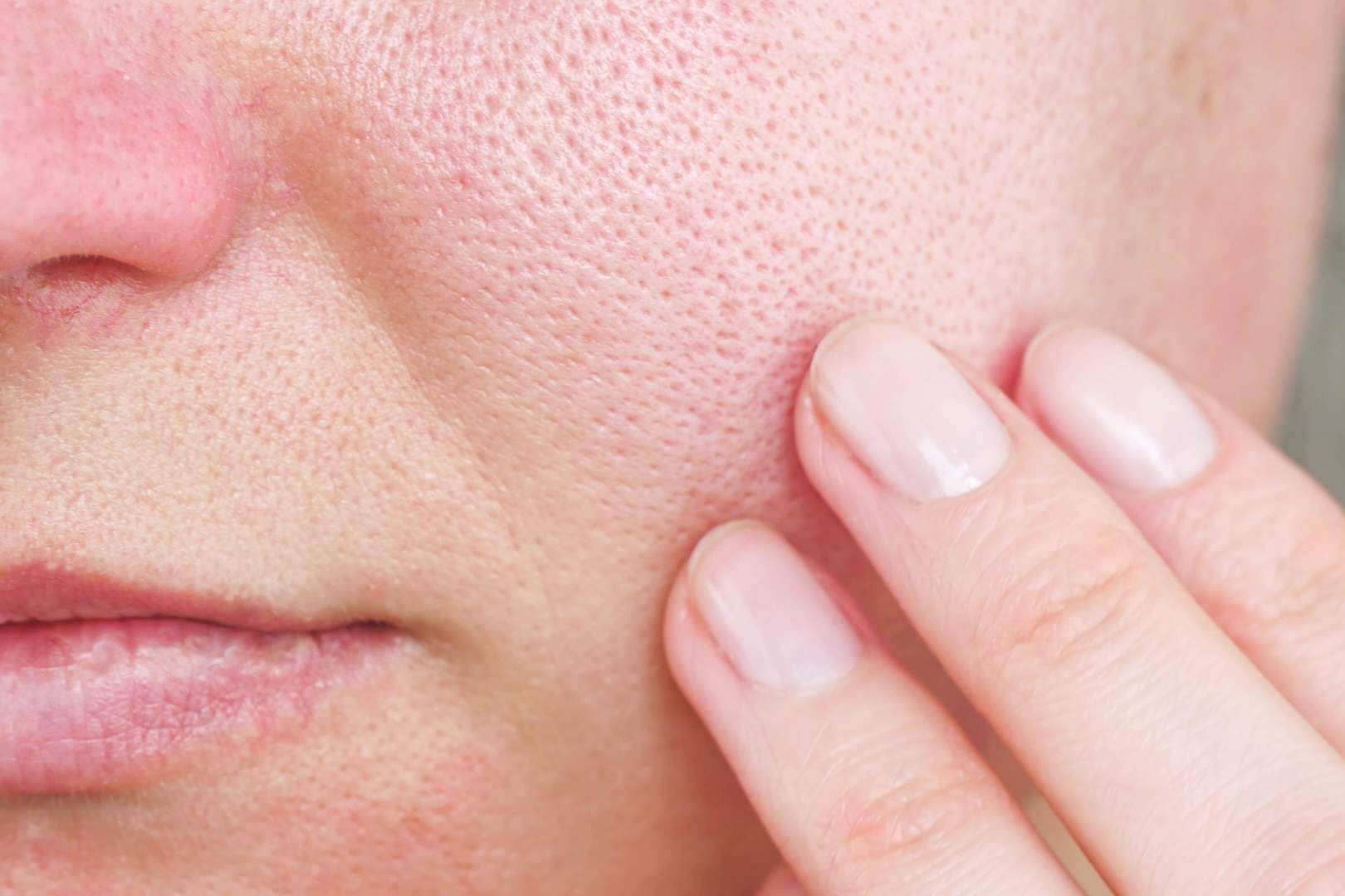 Llega la revolución en el cuidado de la piel sensible; bienestar y belleza sin irritaciones