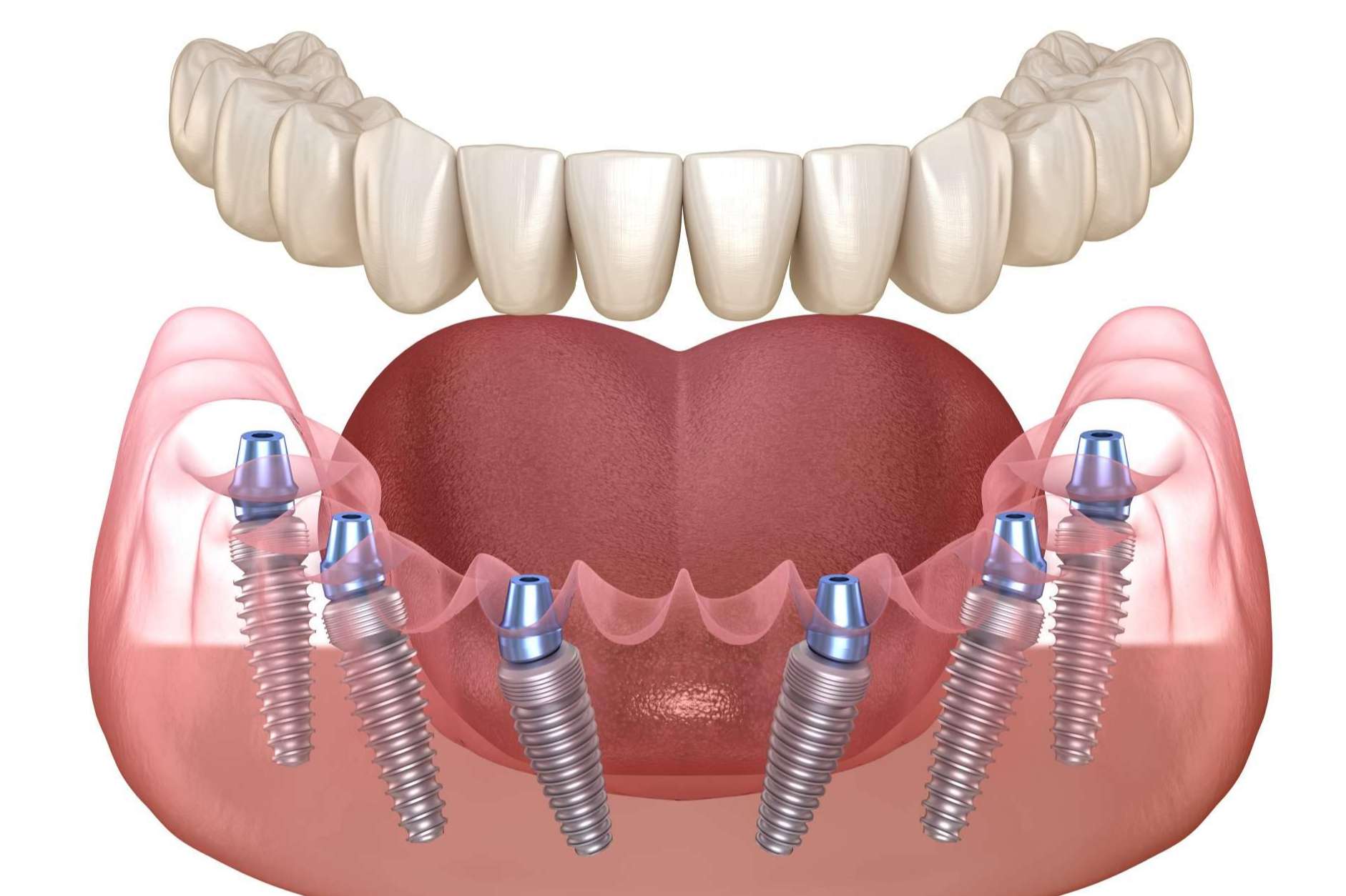 La amplia oferta de servicios odontológicos que pone a disposición la Clínica Dental Arai