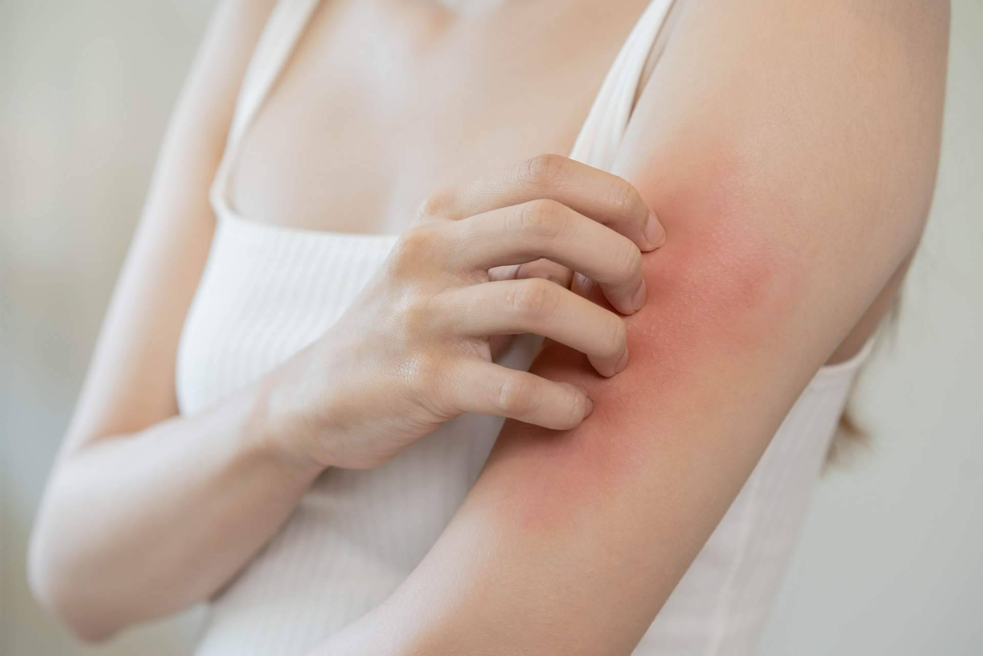 Solucionar problemas de piel sensible con DOCTOR KLEIN
