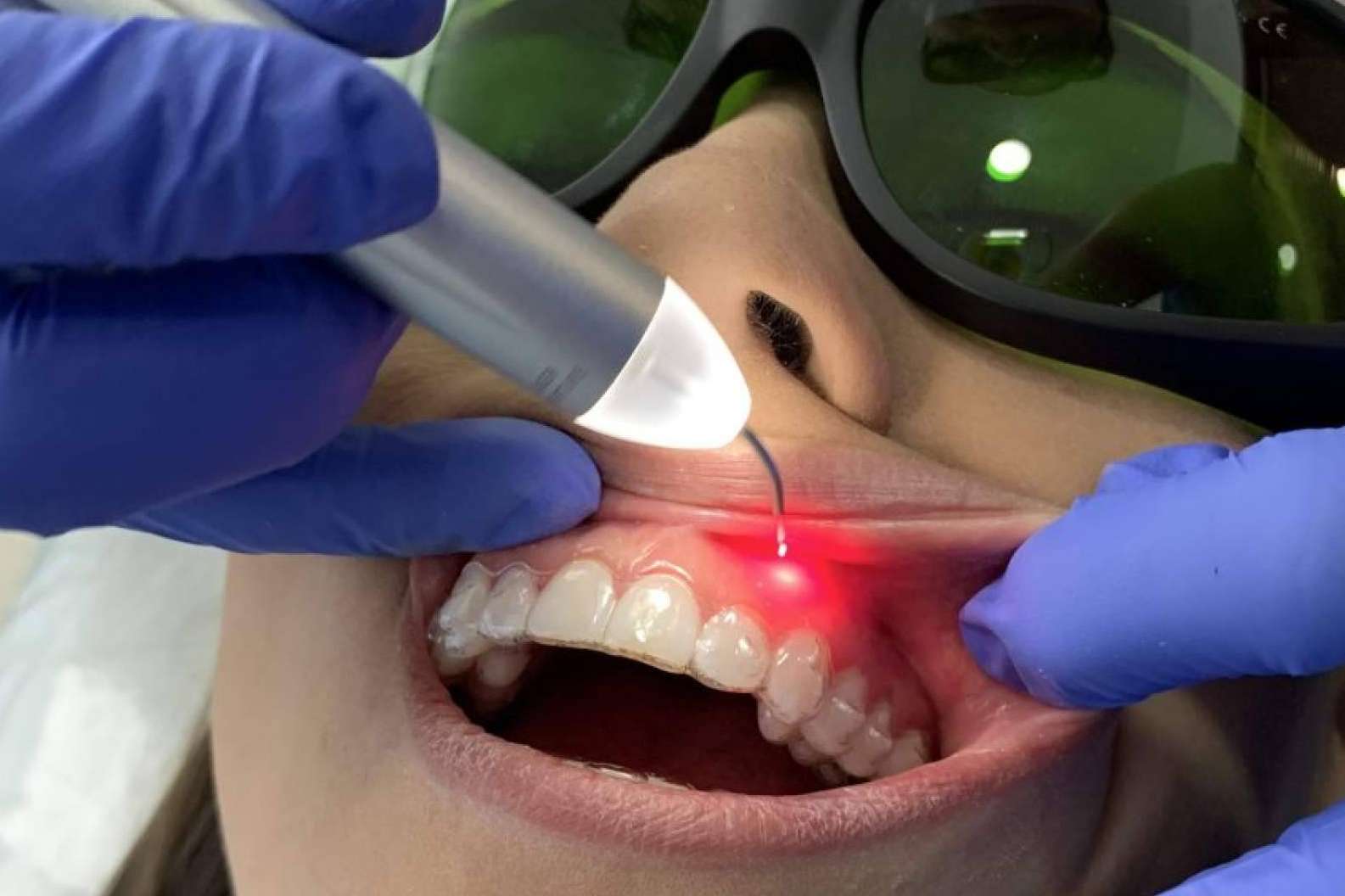 Las últimas tecnologías de estética dental con Dental Implantologie