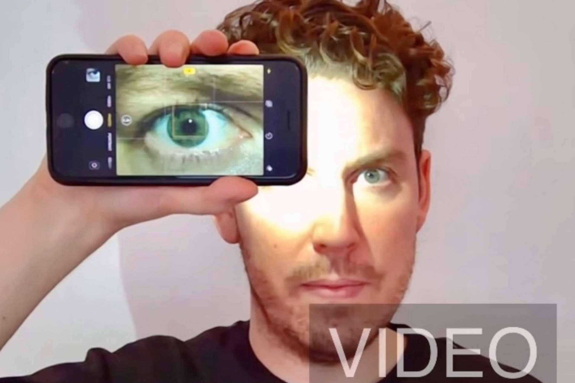 Tomar fotos del iris HD con un smartphone es posible con la técnica de Clínica Eyecos