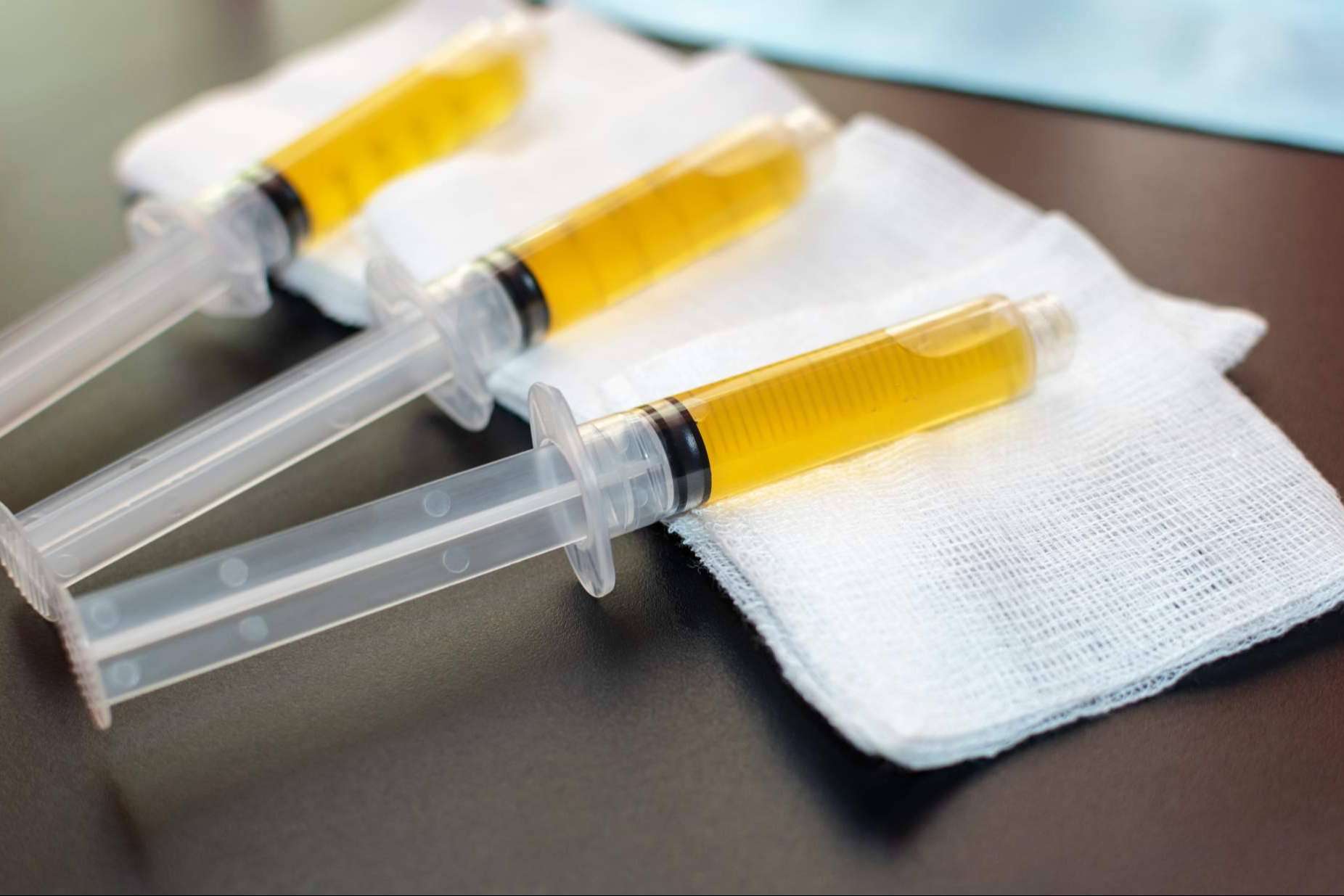 Traumatología, todo sobre el papel del plasma rico en plaquetas