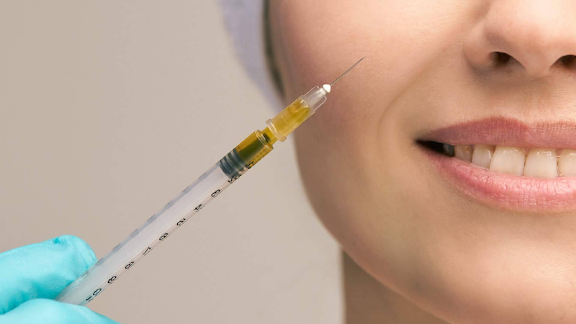 Centro Estética El Pilar, plasma rico en plaquetas facial