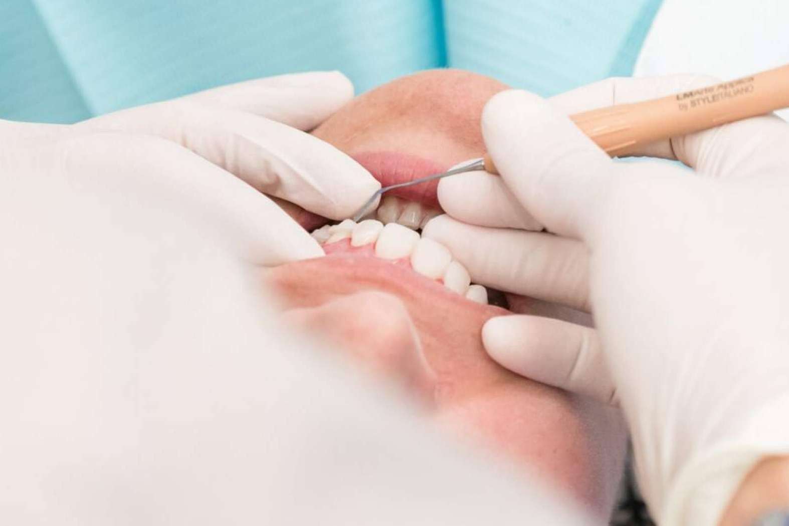 La importancia de la prevención y el tratamiento de las enfermedades periodontales