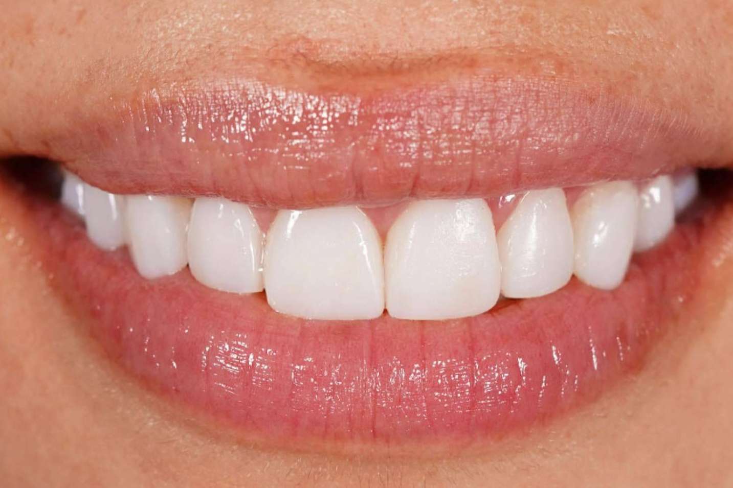 Denty Dent, especialistas en tratamientos de estética dental