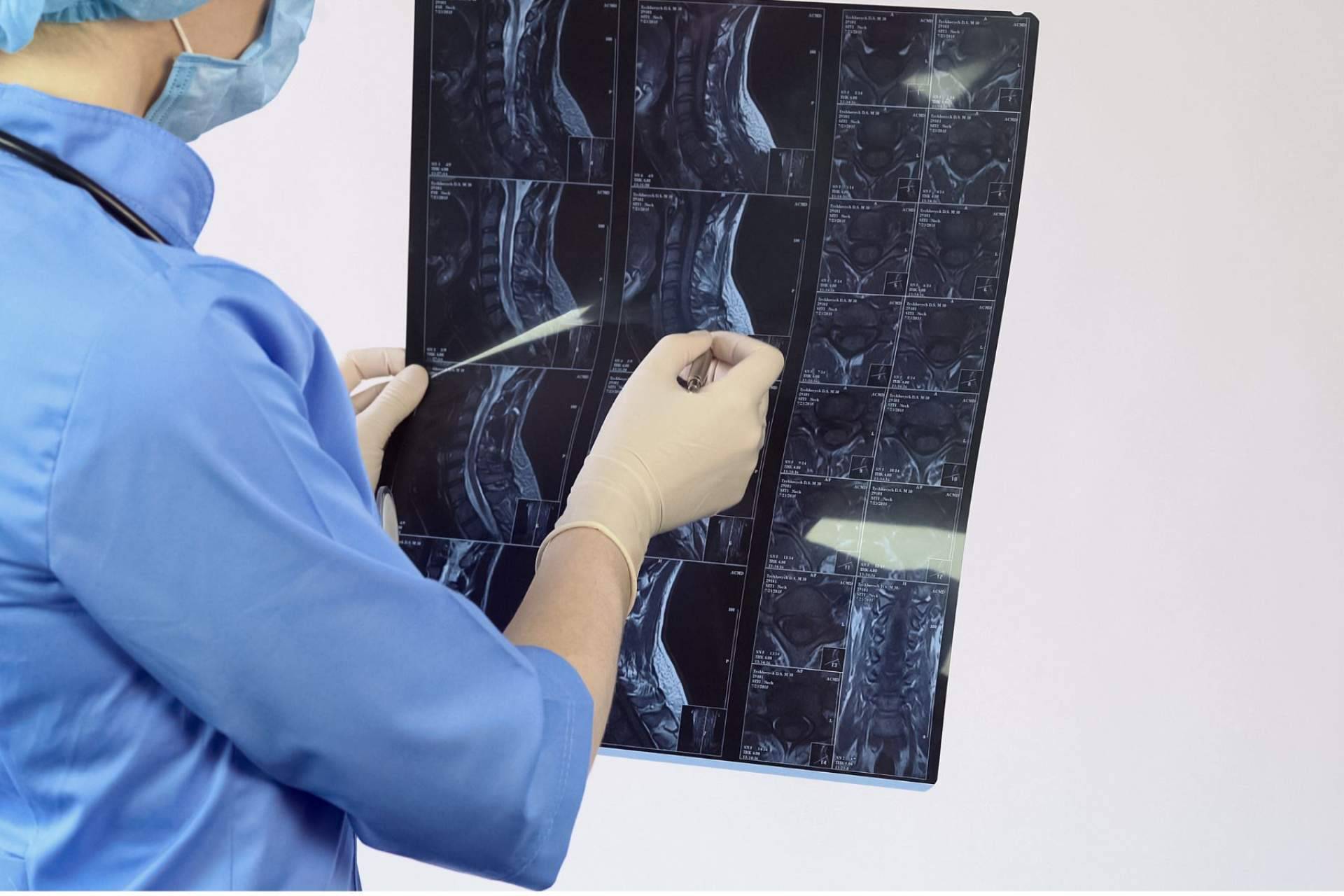 ¿Cómo tratar una hernia de disco? Neurocirugía Galarza