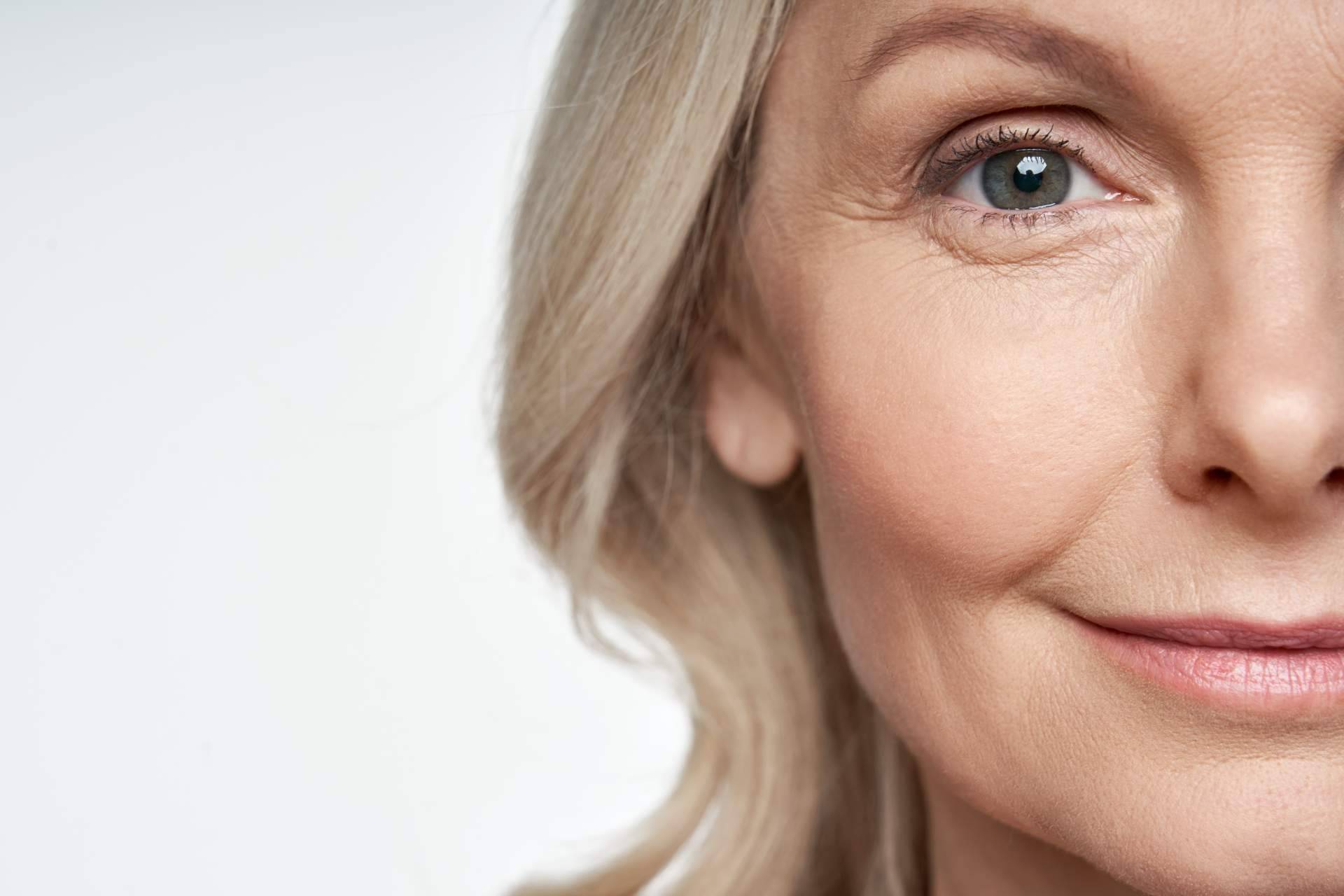 Cuáles son los beneficios del dermapen para poros y arrugas, por G&G Beauty