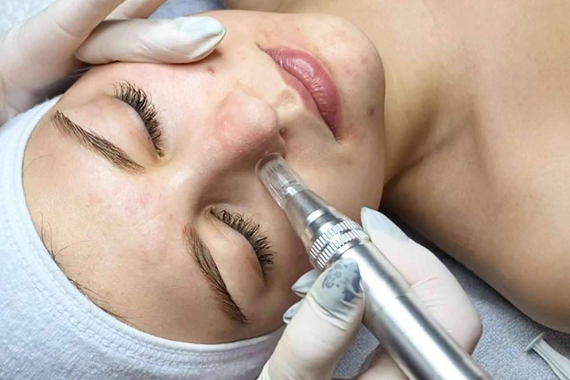 Cynthia Micro & Beauty, un centro de estética en Terrassa y Madrid