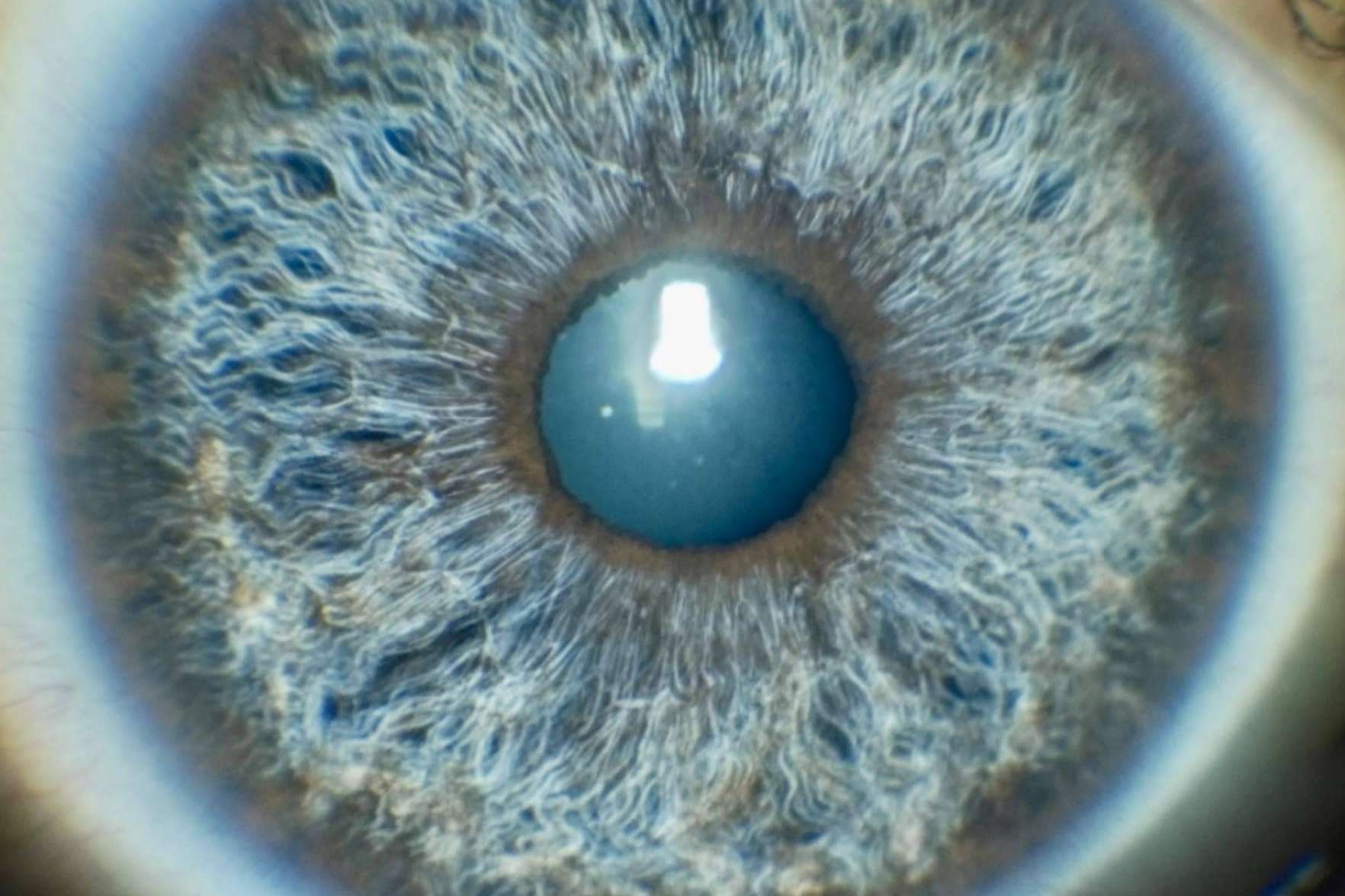 Predecir y simular en 3D el resultado del cambio de color de ojos con láser es posible con Eyecos