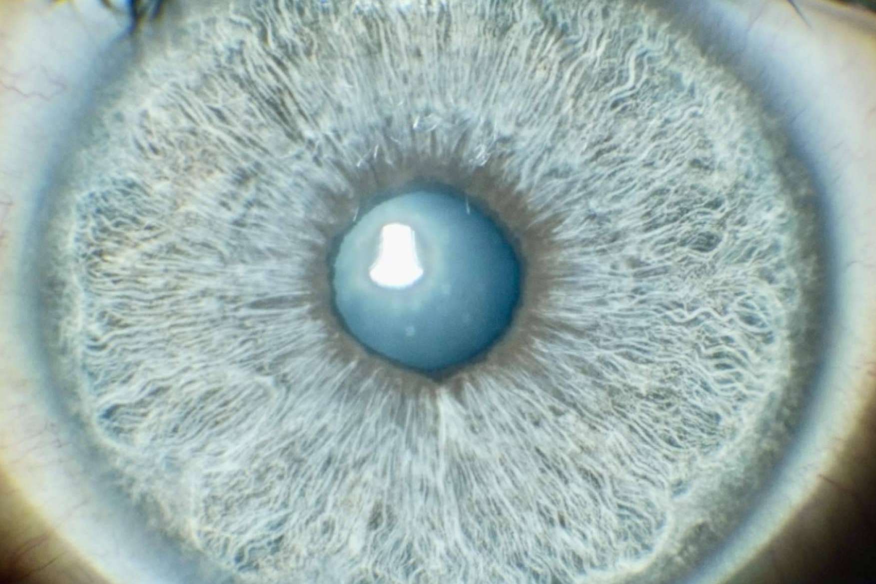 Cuáles son los motivos para querer cambiarse el color de los ojos con láser, por Eyecos