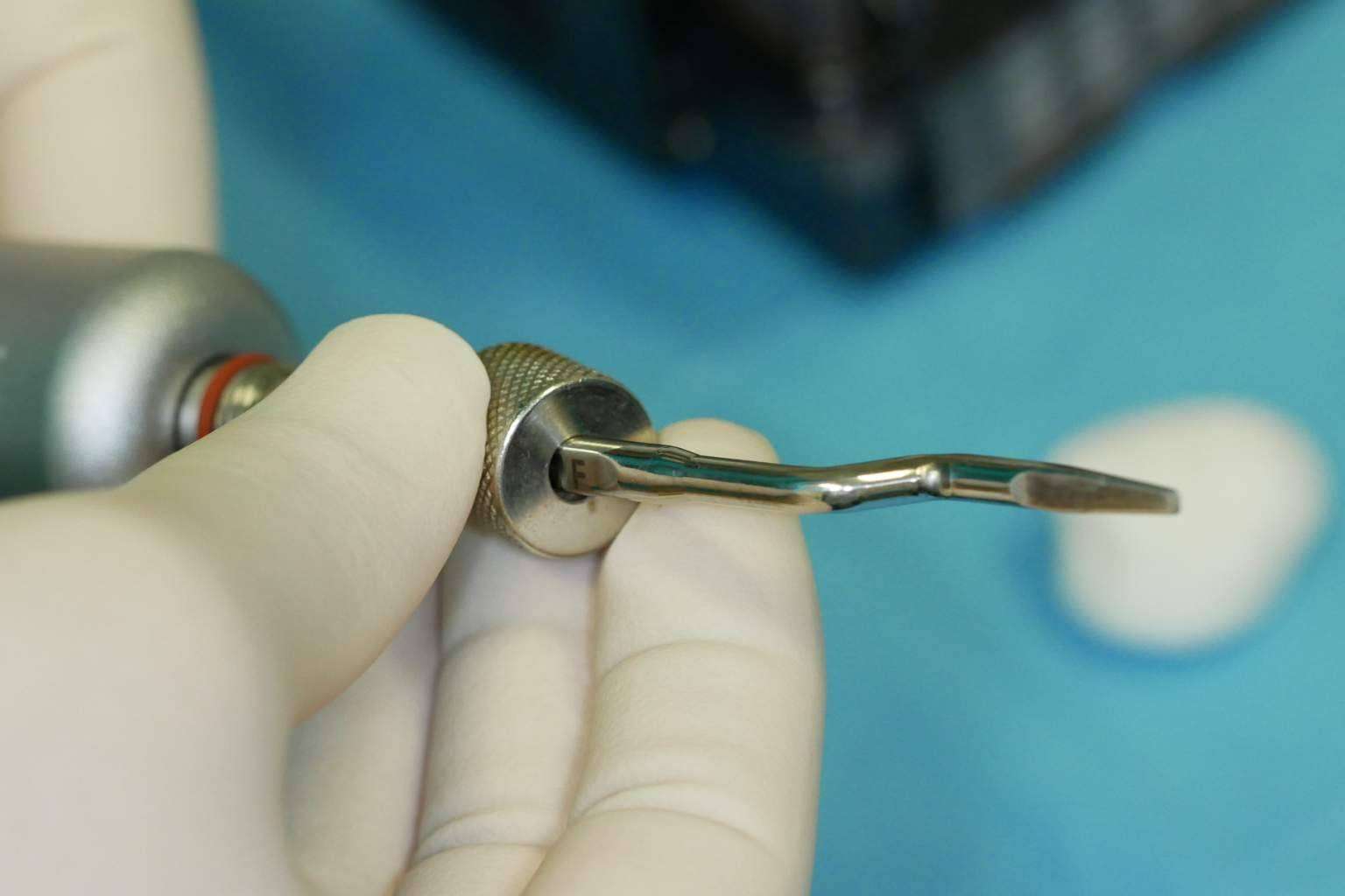 Los especialistas en recuperar la sonrisa y la salud bucodental con implantes dentales cerámicos de Clínica Biorigenera