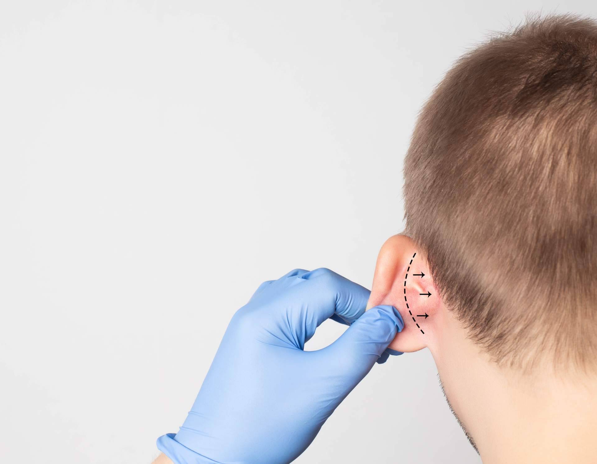 Realizarse una operación y cirugía otoplastia en el Centro Médico El Pilar