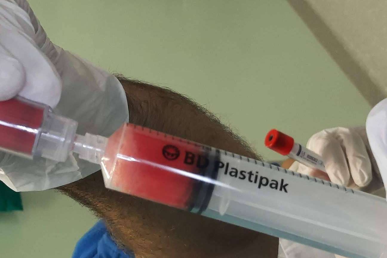 Un tratamiento eficaz sin cirugía para artrosis de rodilla, las infiltraciones de plasma rico en plaquetas y células madre