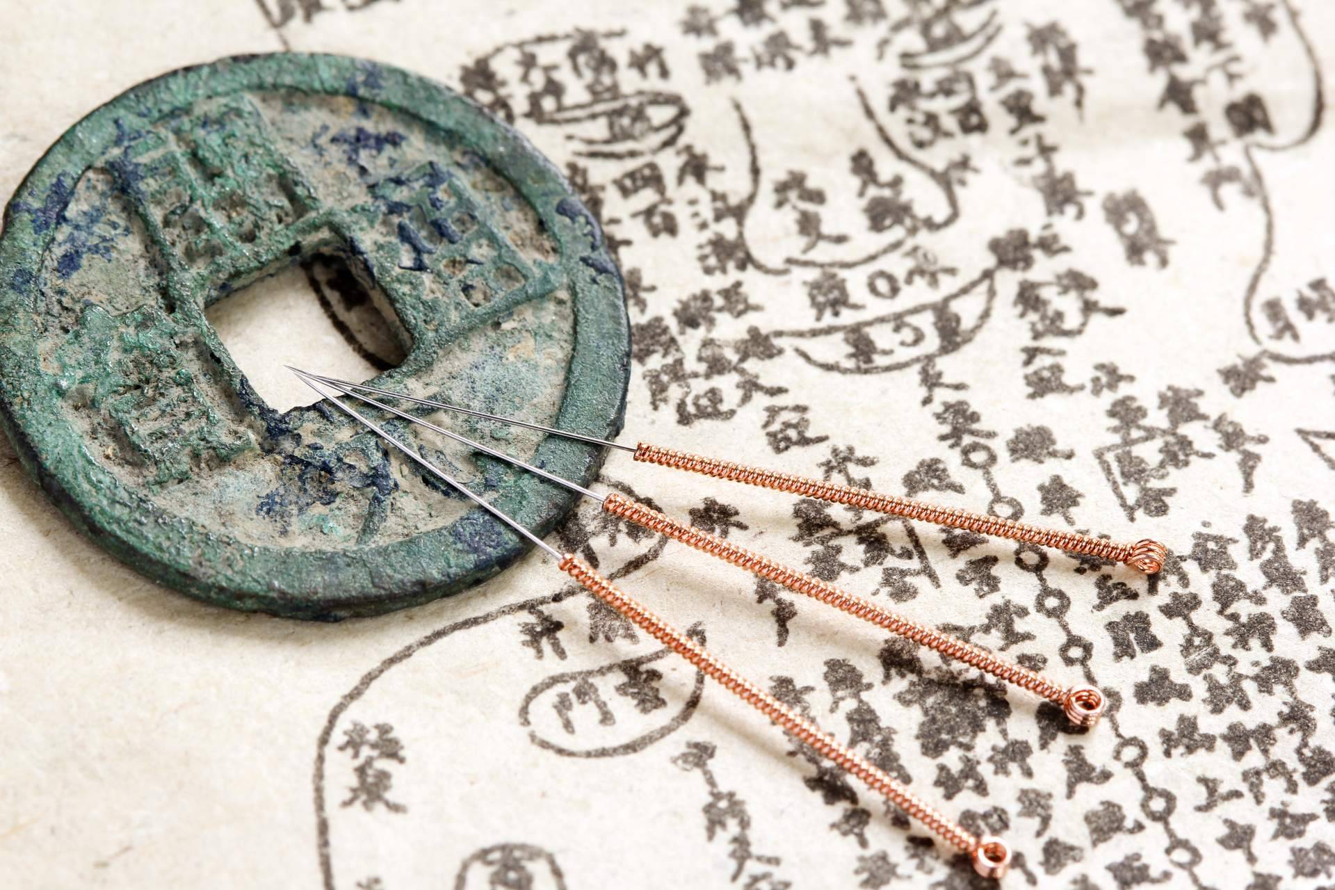 Una forma no invasiva de lograr la curación es la Medicina Tradicional China