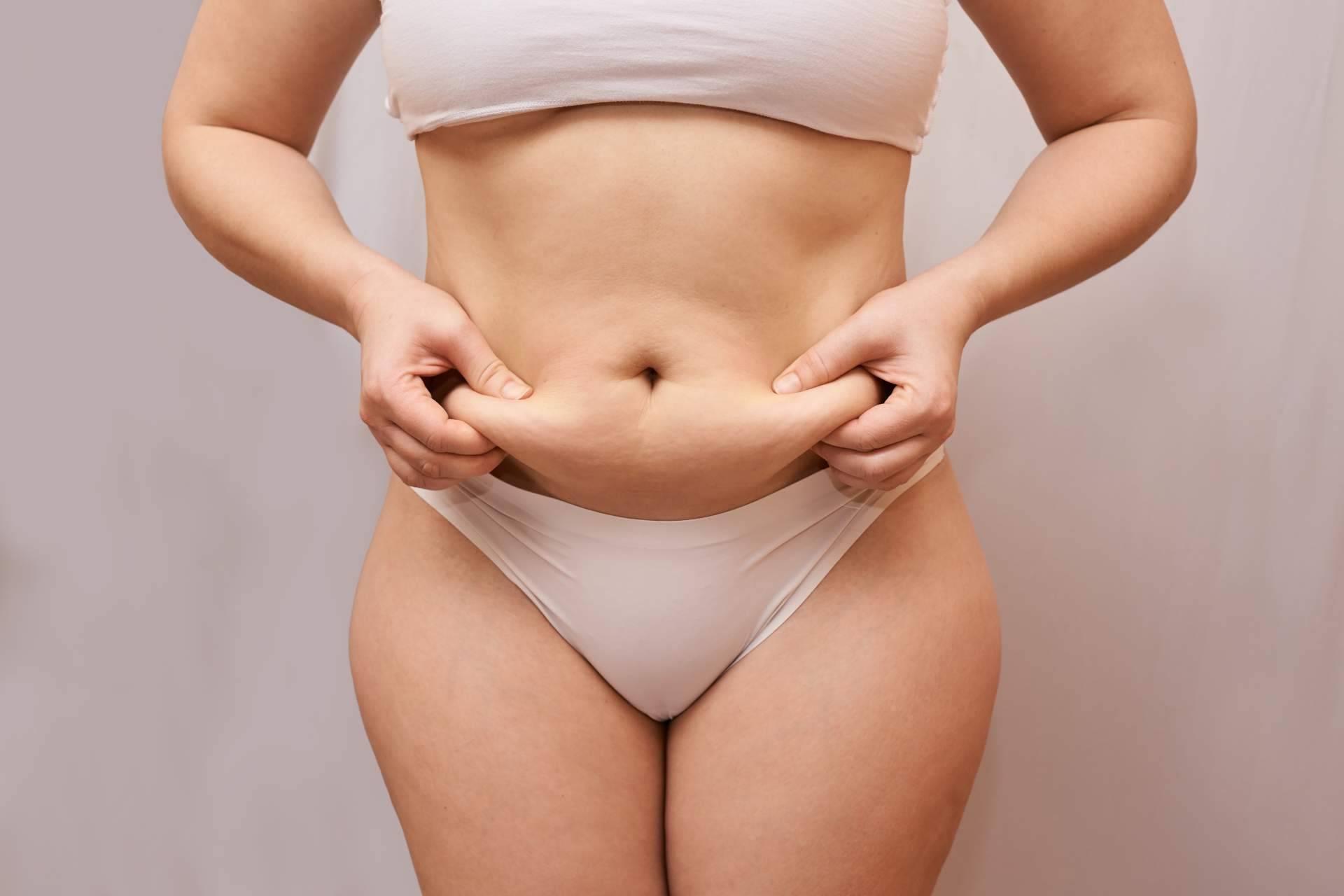 Abdominoplastia, una solución efectiva y segura para recuperar el abdomen plano