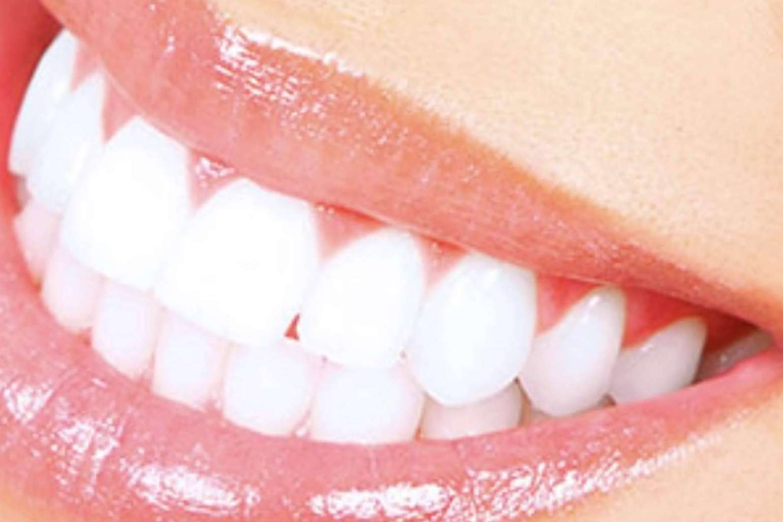 Clínica Dental Jorge del Corral en Hortaleza, Madrid; calidad en prótesis fija estética de zirconio