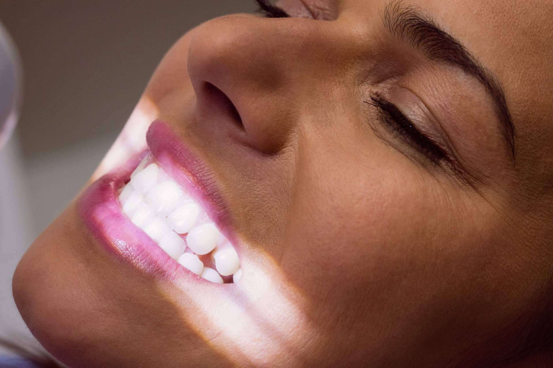 Clínica Calvo de Mora lanza promoción del 50% en blanqueamiento dental este verano 2025