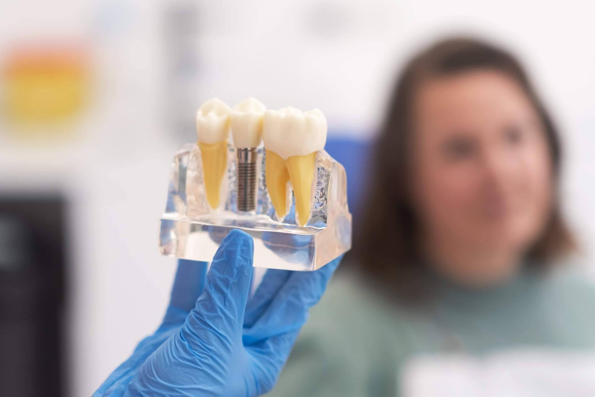 CML Odontólogos explica el por qué del éxito de los implantes de carga inmediata