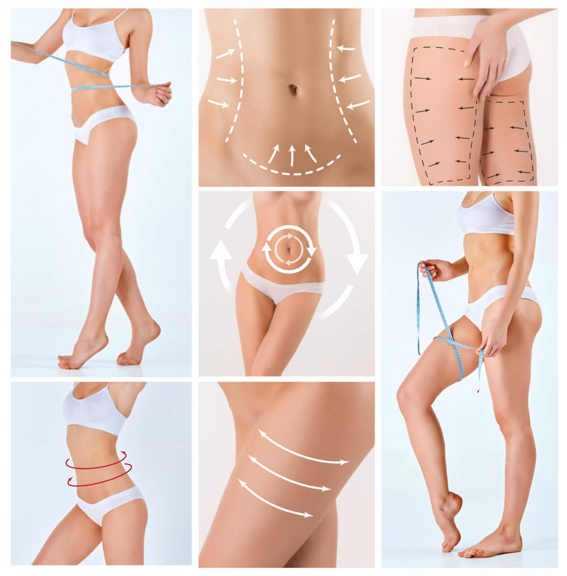 Lipoescultura HD con tecnología Lipováser, el nuevo estándar en cirugía corporal de Beauty&Beauty